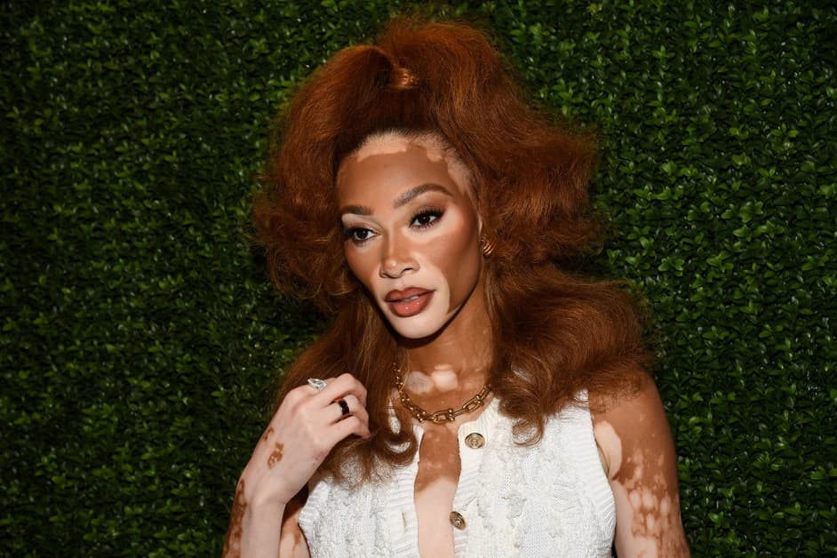 Winnie Harlow Addresses Backlash Over Whitney Houston Halloween Costume
