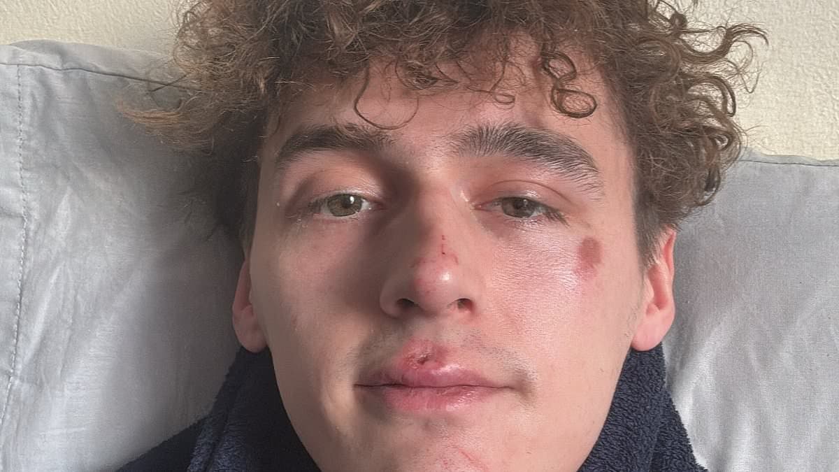 Big Brother Winner Cameron Cole Assaulted in Homophobic Attack While Celebrating Birthday